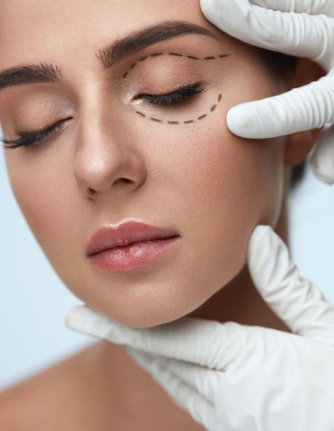 dra-caroline-beal_blefaroplastia