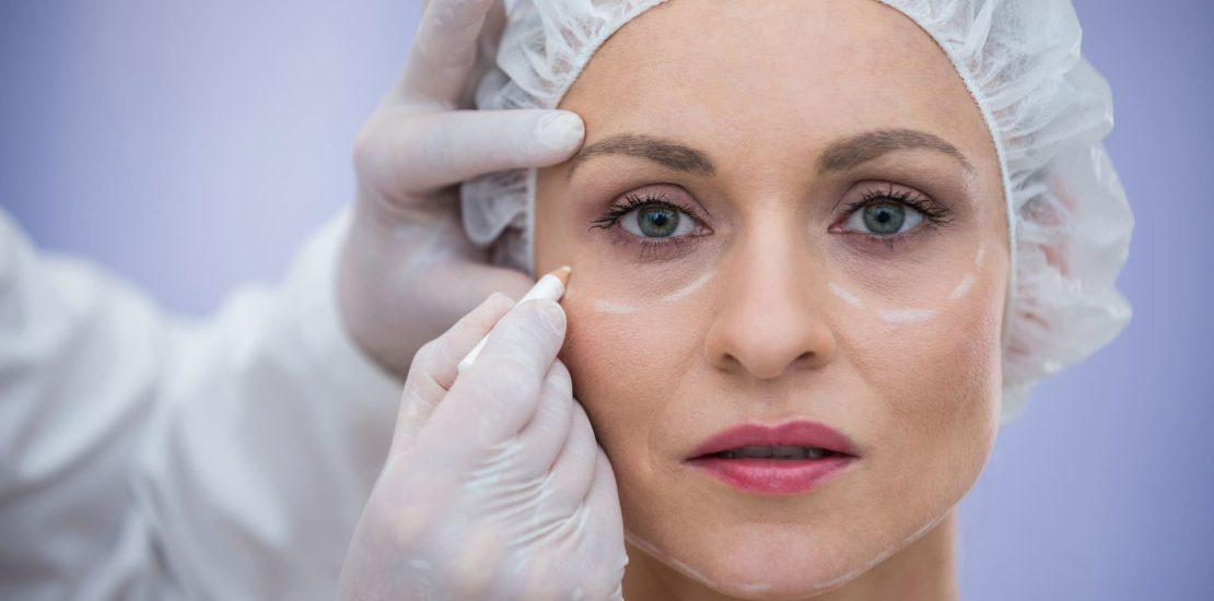 dra-caroline-beal_blog_blefaroplastia (1) (1)