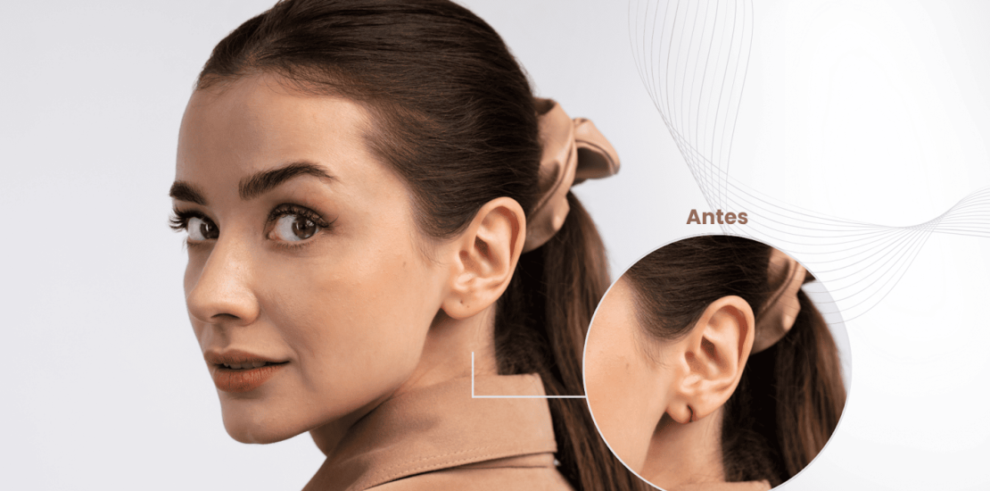 dra-caroline-post-blog-Orelha-rasgada-como-corrigir (2)